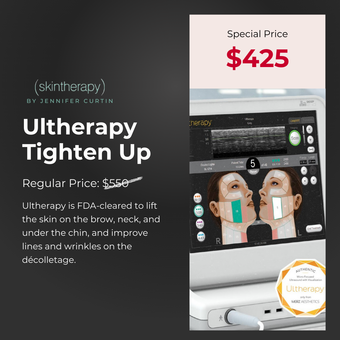 Ultherapy Tighten Up