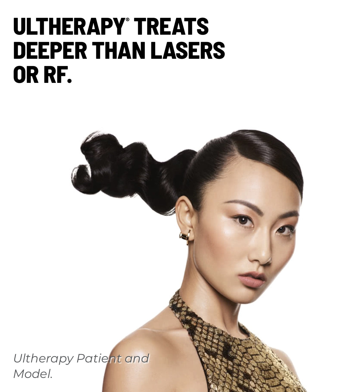 Ultherapy Lower Face & Neck